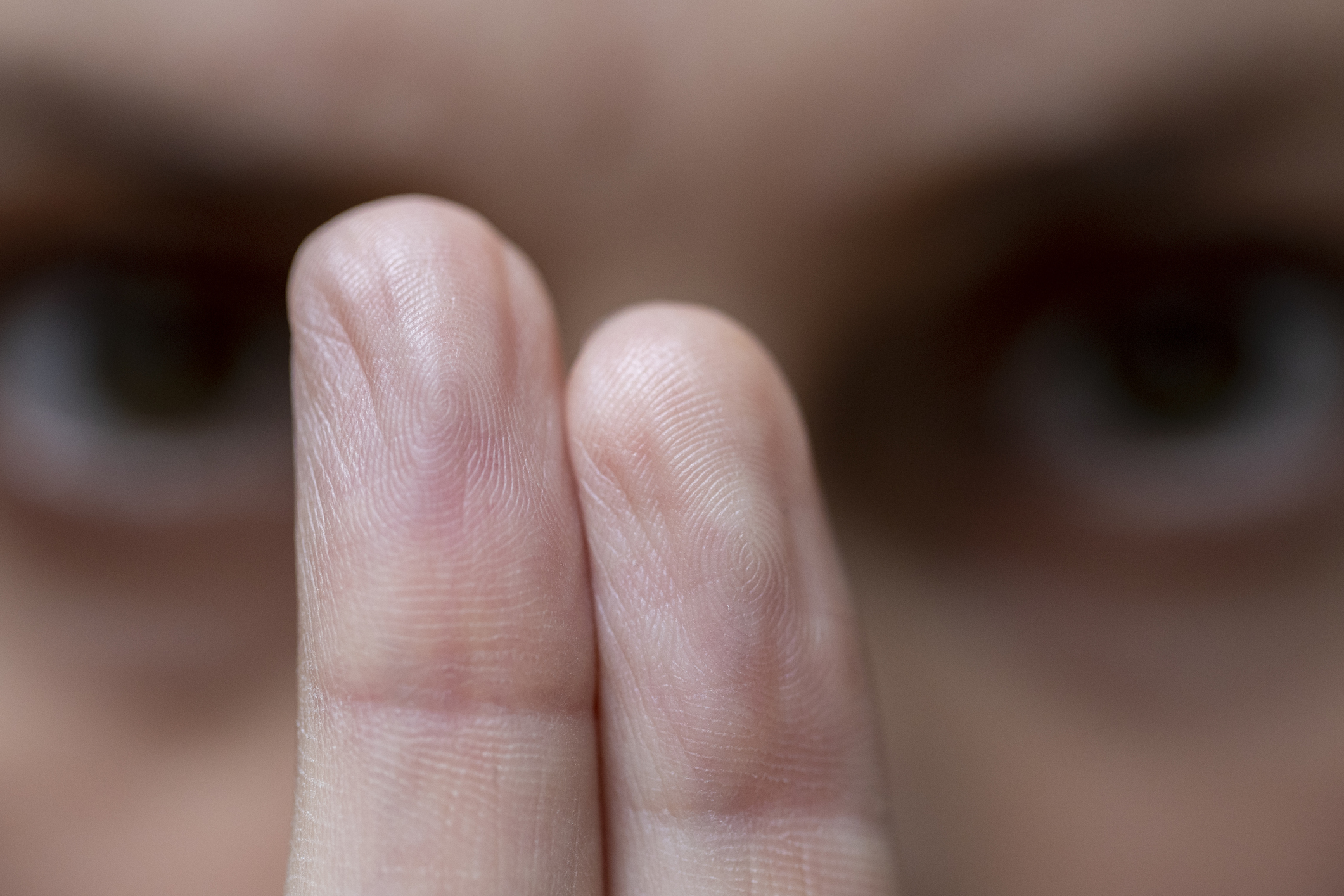 Emdr, Therapy By Bi Alternating Sensory Stimulation (right Left) Which Is Practiced By Eye Movements